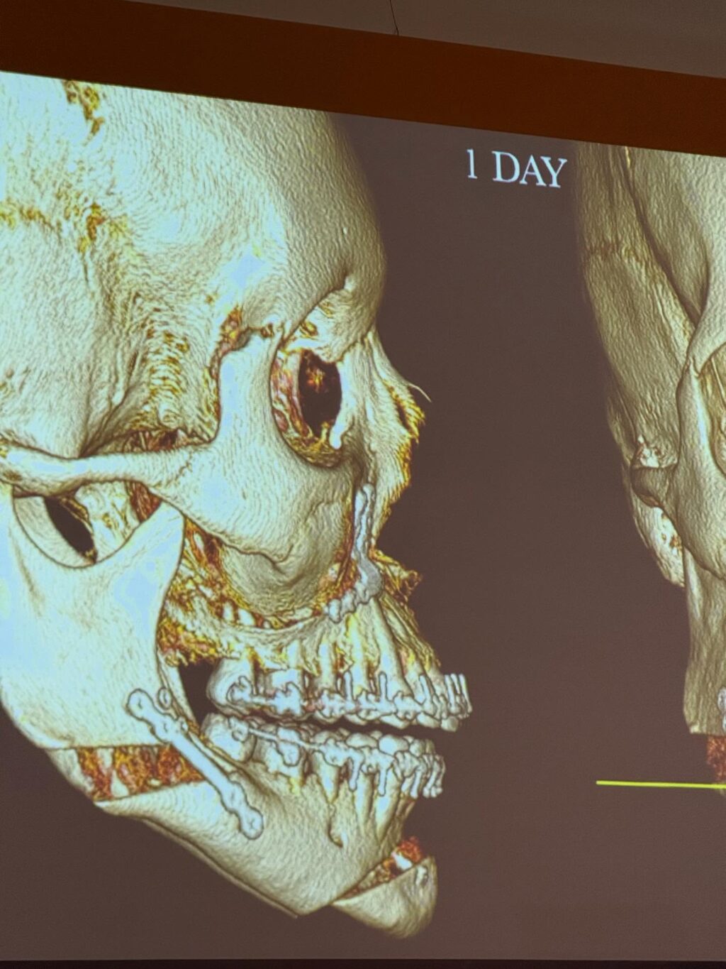 Instagram post from draleticiacasassola. This post is in position 1.